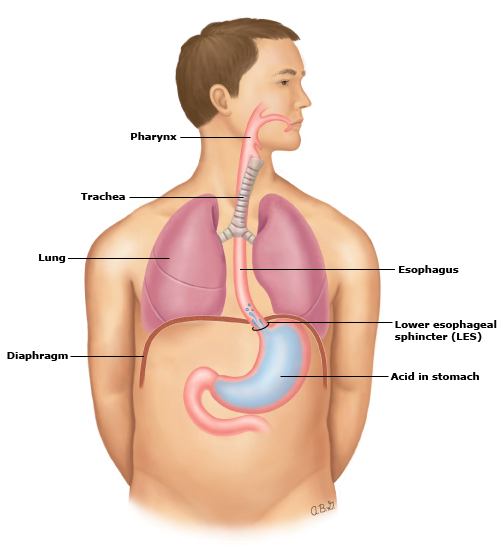 Illustration of the esophageal sphincter