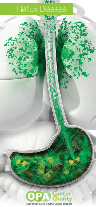 Reflux Disease Leaflet Reflux Disease Leaflet